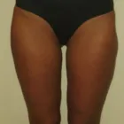 Unternehmen 3 Bild FETT ABNEHMEN IM SCHLANKHEITSSTUDIO WIEN Kosmetiksalons am Wien 9